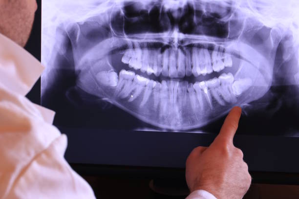 Best Emergency Root Canal Treatment in Lumberton, NC