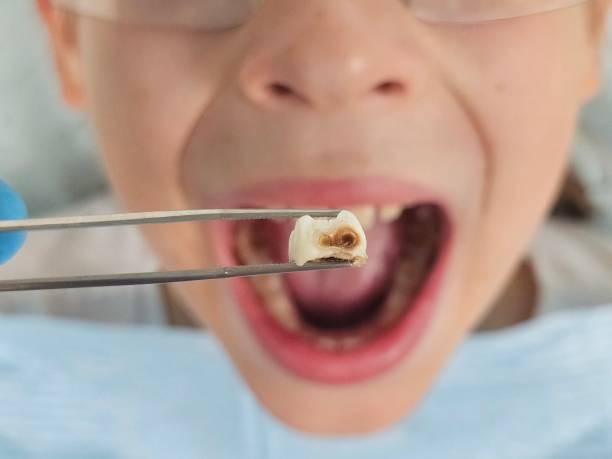 Best Same-Day Emergency Dentist in Lumberton, NC
